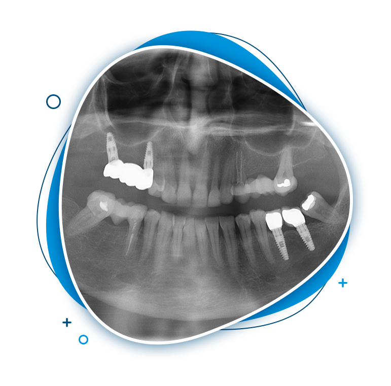 geelong dental and implant centre