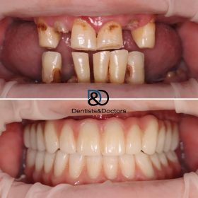 44172696 1fa1 44cd a63c 6cf53742320c