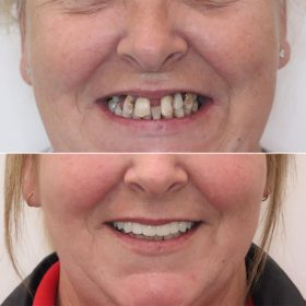 PLS-De-Identify-this-patient (1)