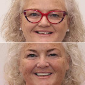 PLS-De-Identify-this-patient2