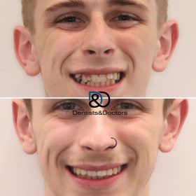 a24d045d-78c7-4f36-8f82-6721fa2302c7